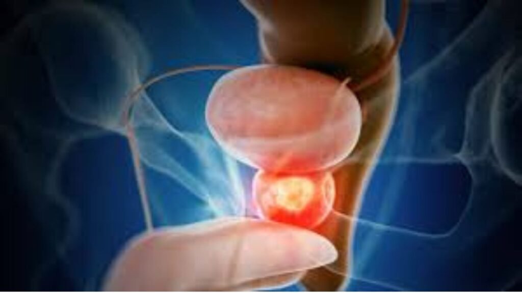 Prostate Health Guide for Men Over 50: How to Boost Vitality Naturally 7 Prostate Health