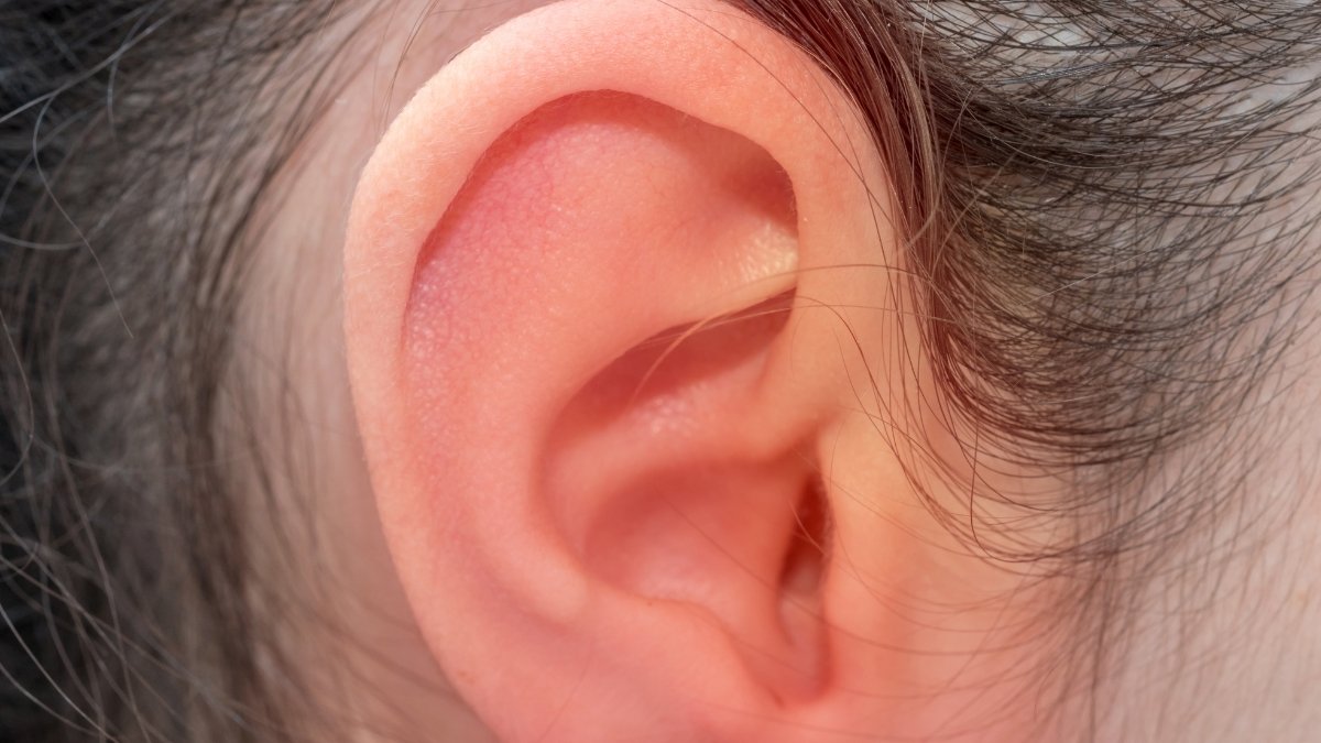 What Causes Tinnitus and How to Reduce It