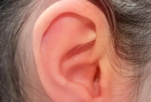 What Causes Tinnitus and How to Reduce It