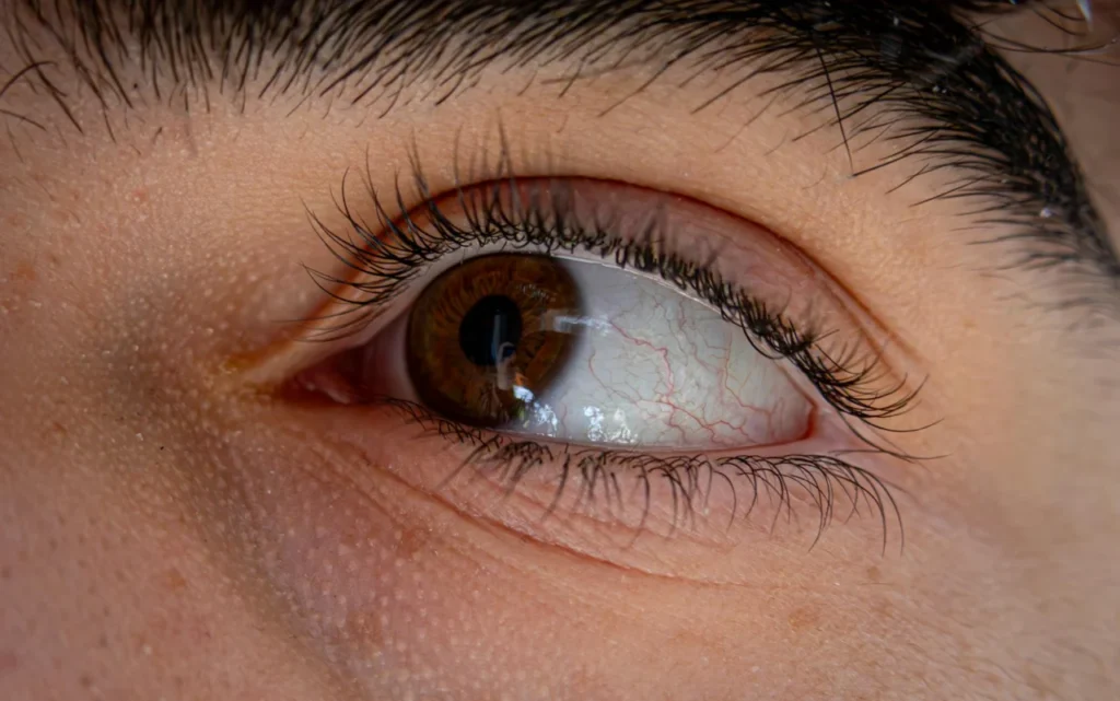 Early Signs of Nerve Damage