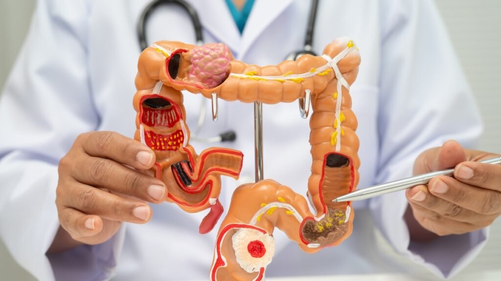 Best Probiotics for Gut Health: What Works and What to Avoid