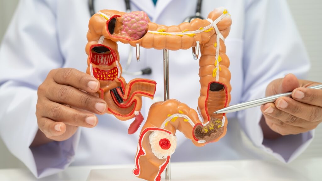 Foods That Heal the Gut                              