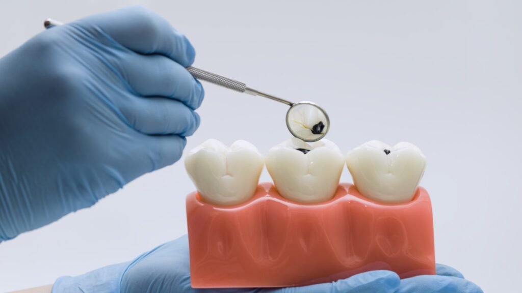 Natural Remedies for Gum Disease