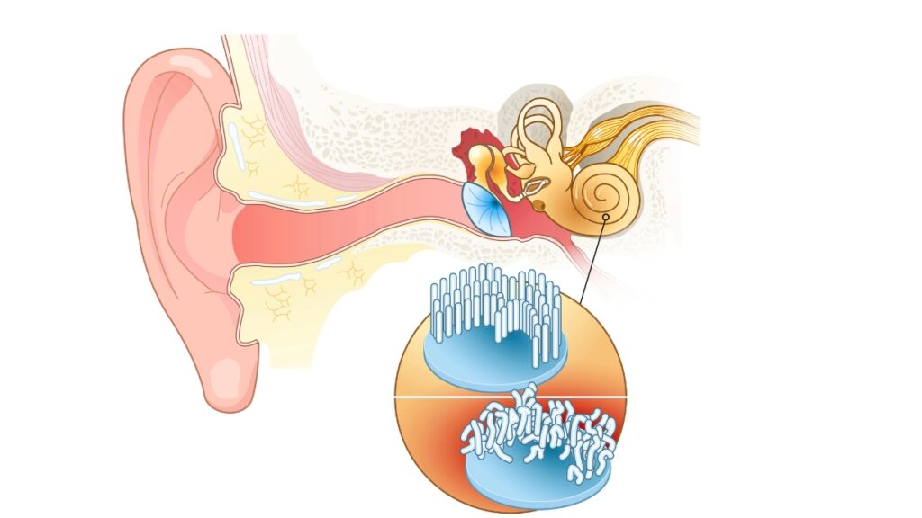 Can Hearing Loss Be Reversed Naturally?