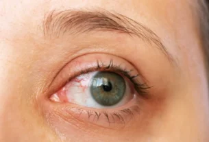 Signs Your Vision Is Getting Worse