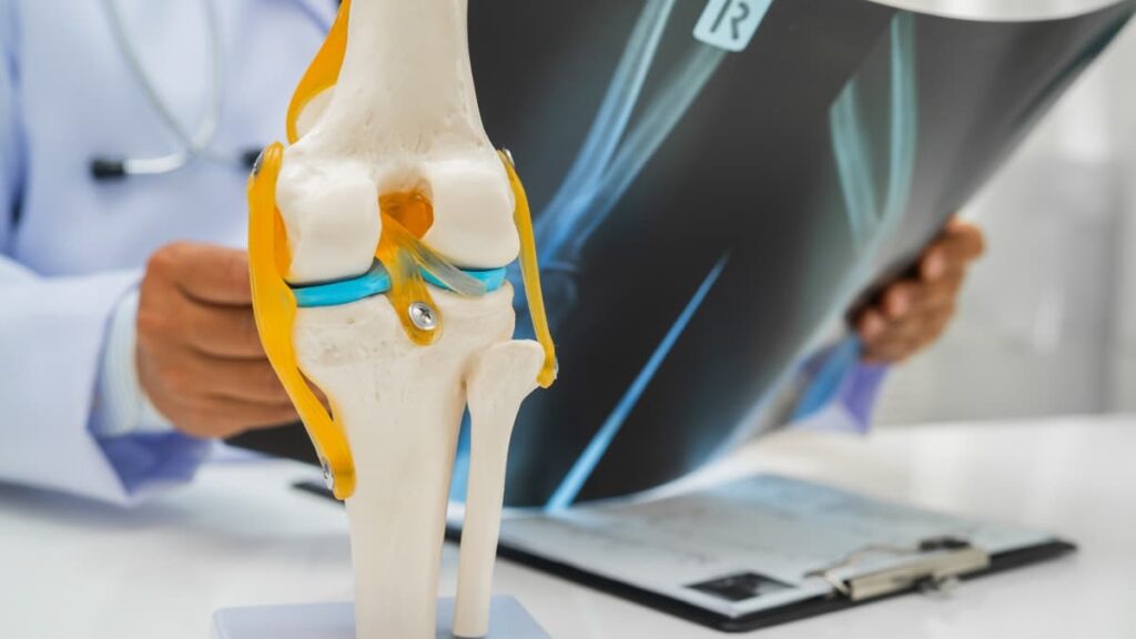 Healthy foods and joint support supplements commonly associated with cartilage and mobility support
