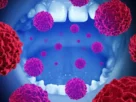 Signs of Gum Infection