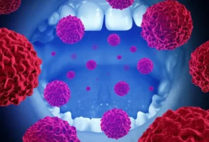 Signs of Gum Infection