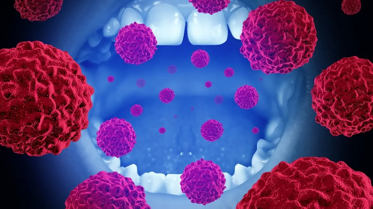 Signs of Gum Infection